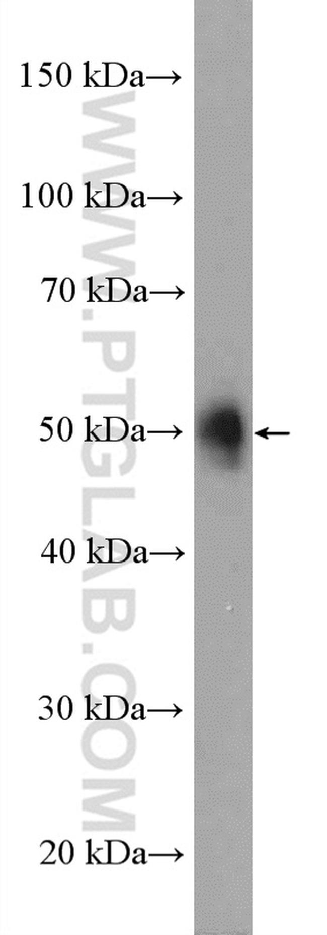 LAP3 Antibody in Western Blot (WB)