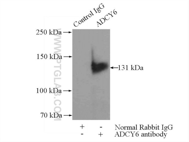 ADCY6 Antibody in Immunoprecipitation (IP)