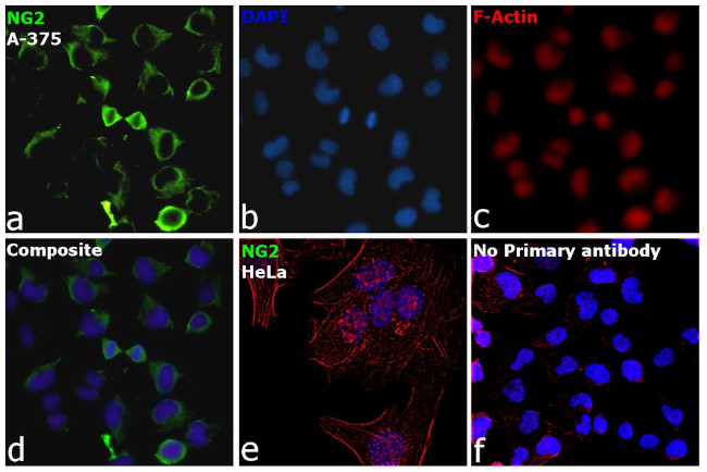 Neural/Glial Antigen 2 (NG2) Antibody in Immunocytochemistry (ICC/IF)