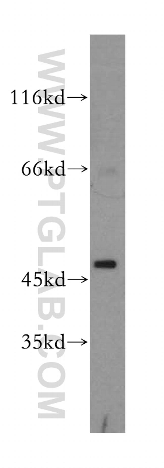 Decorin Antibody in Western Blot (WB)