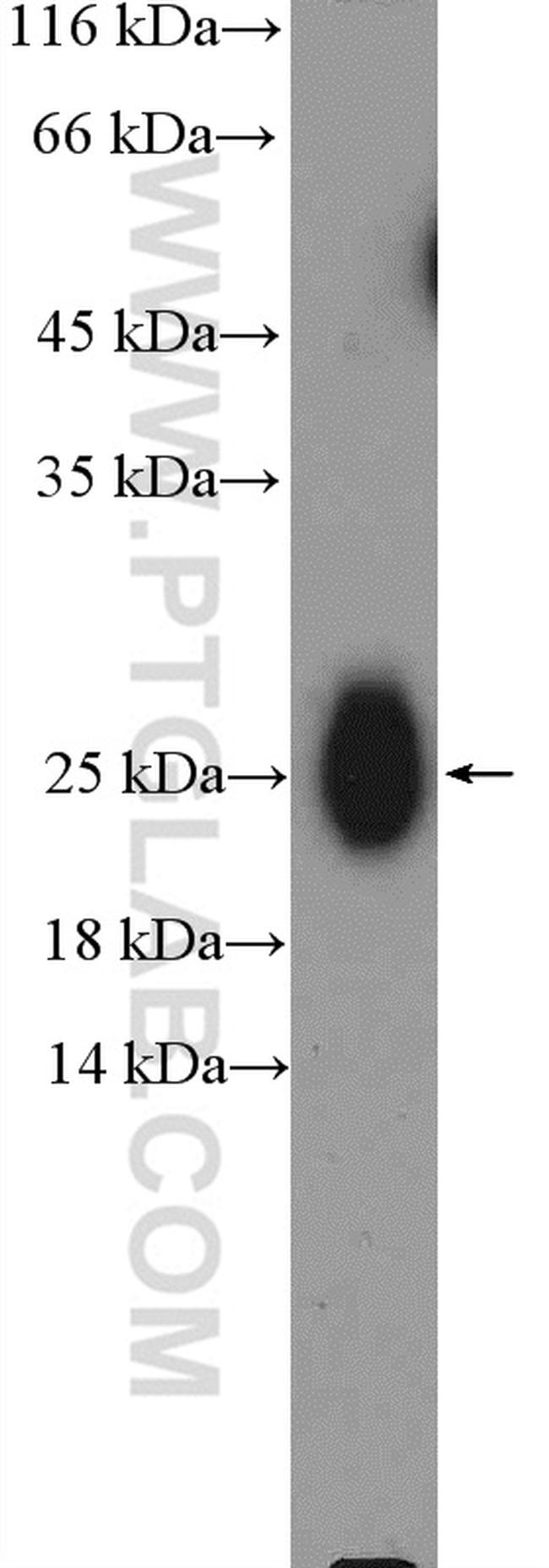 IgG light chain (Kappa) Antibody in Western Blot (WB)