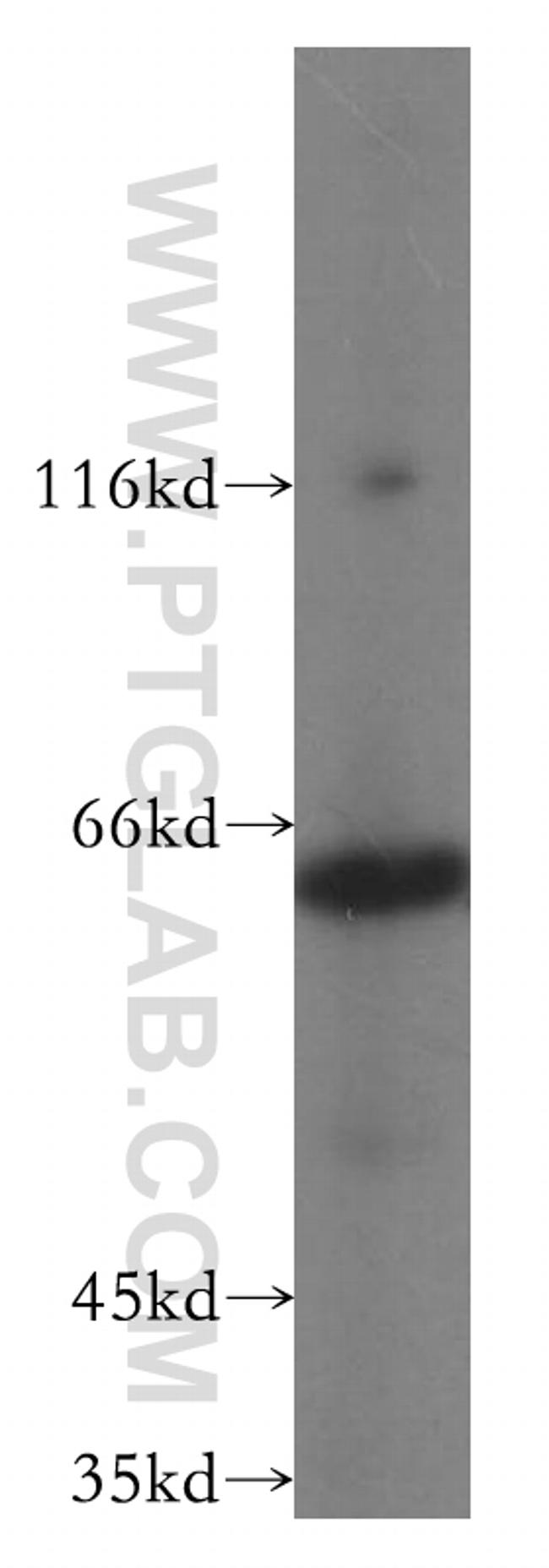 PAK4 Antibody in Western Blot (WB)