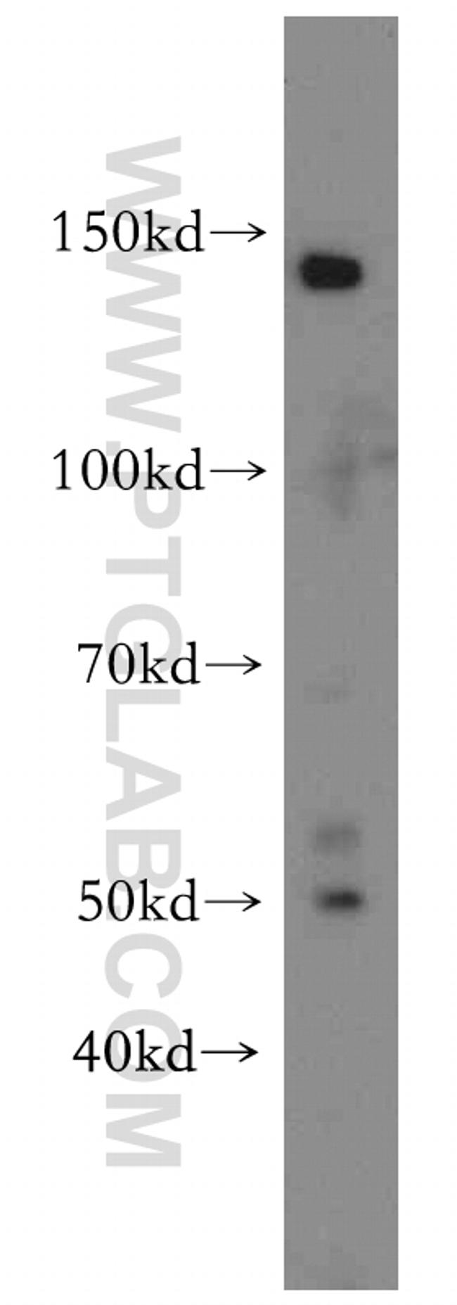 SLC44A1 Antibody in Western Blot (WB)