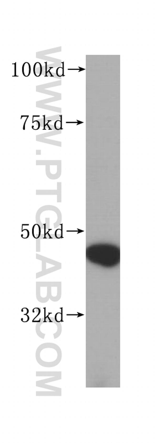 RNMTL1 Antibody in Western Blot (WB)