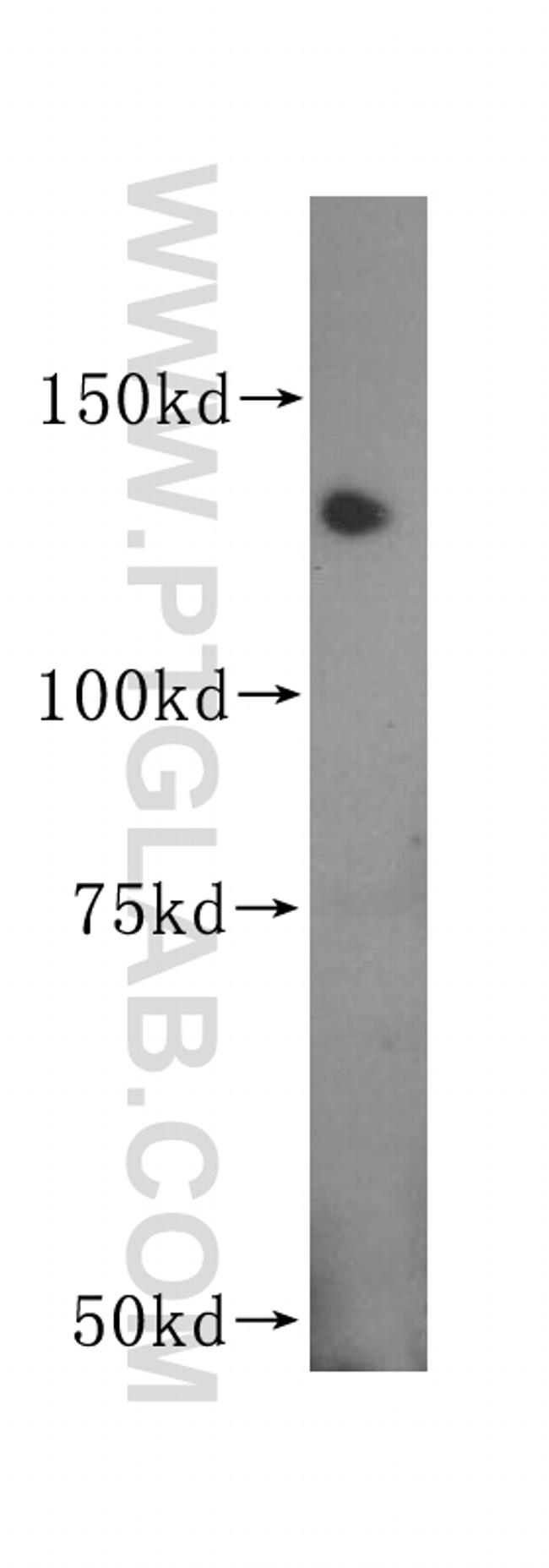 MGEA5 Antibody in Western Blot (WB)