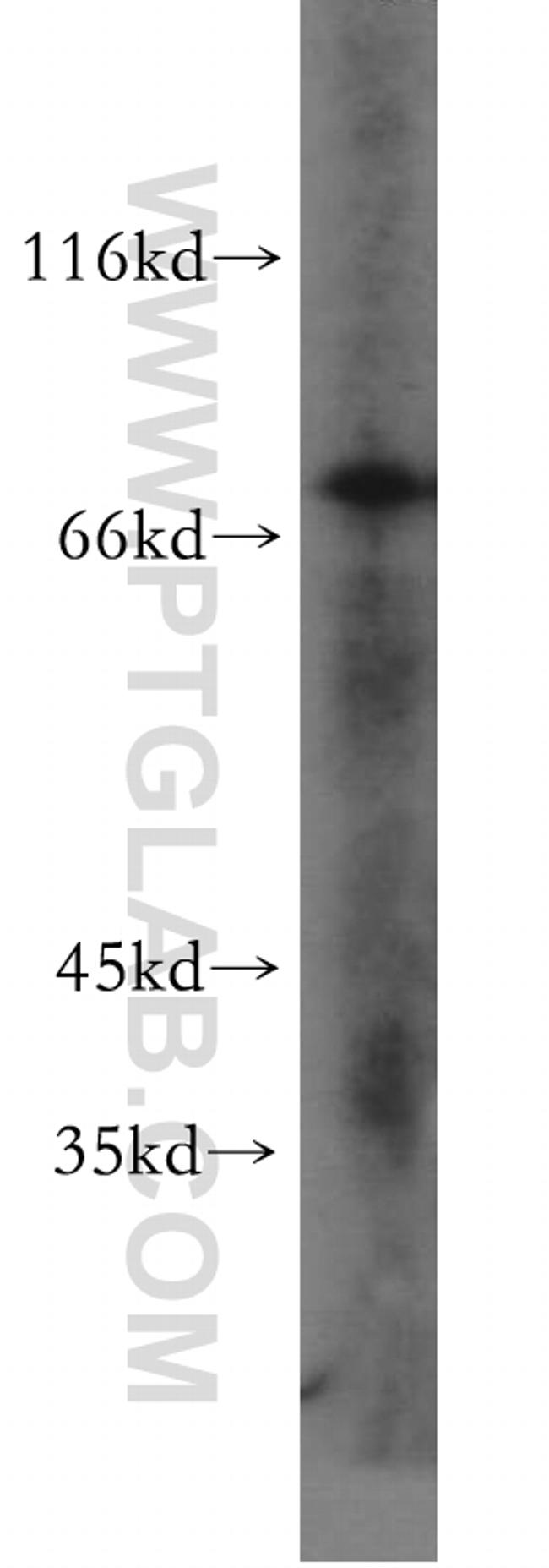 ERp72 Antibody in Western Blot (WB)