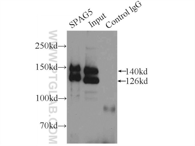 SPAG5 Antibody in Immunoprecipitation (IP)
