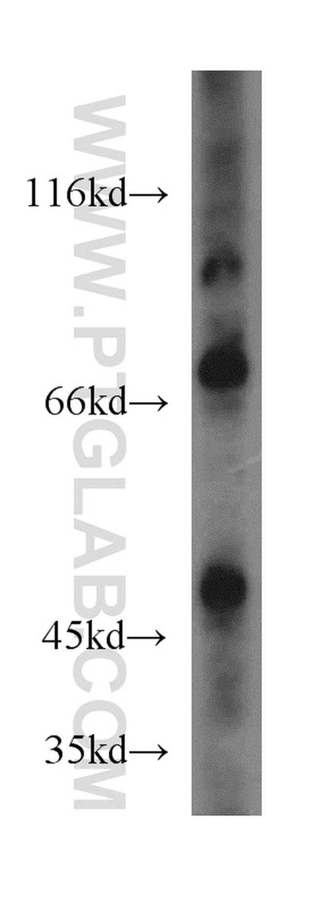 IVNS1ABP Antibody in Western Blot (WB)