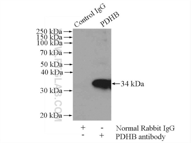 PDHB Antibody in Immunoprecipitation (IP)
