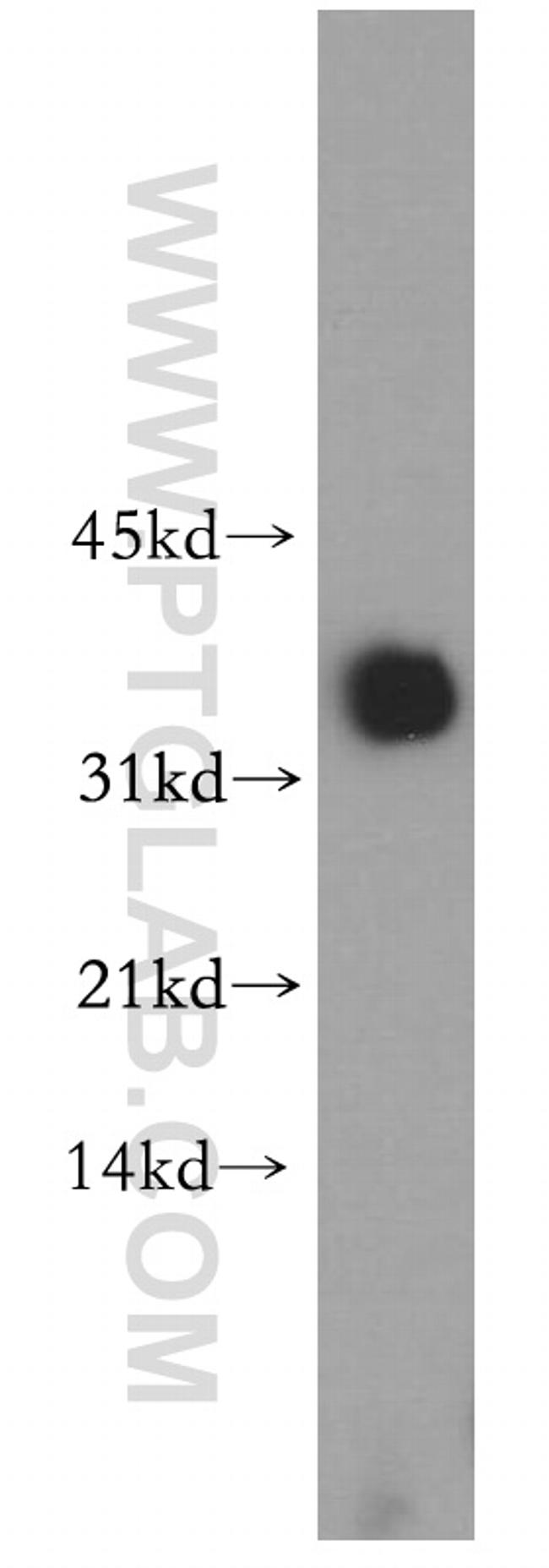 PDHB Antibody in Western Blot (WB)