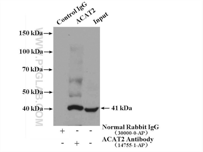 ACAT2 Antibody in Immunoprecipitation (IP)