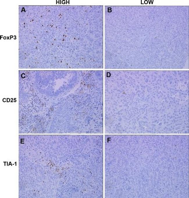 FOXP3 Antibody in Immunohistochemistry (IHC)