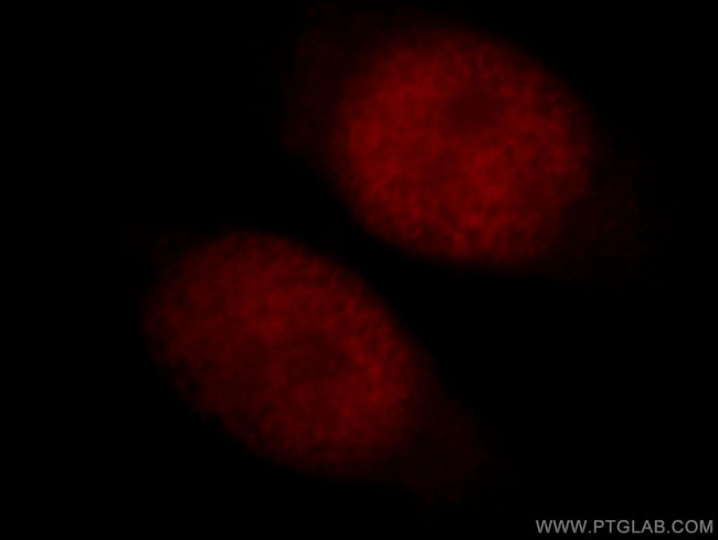 OBFC2B Antibody in Immunocytochemistry (ICC/IF)