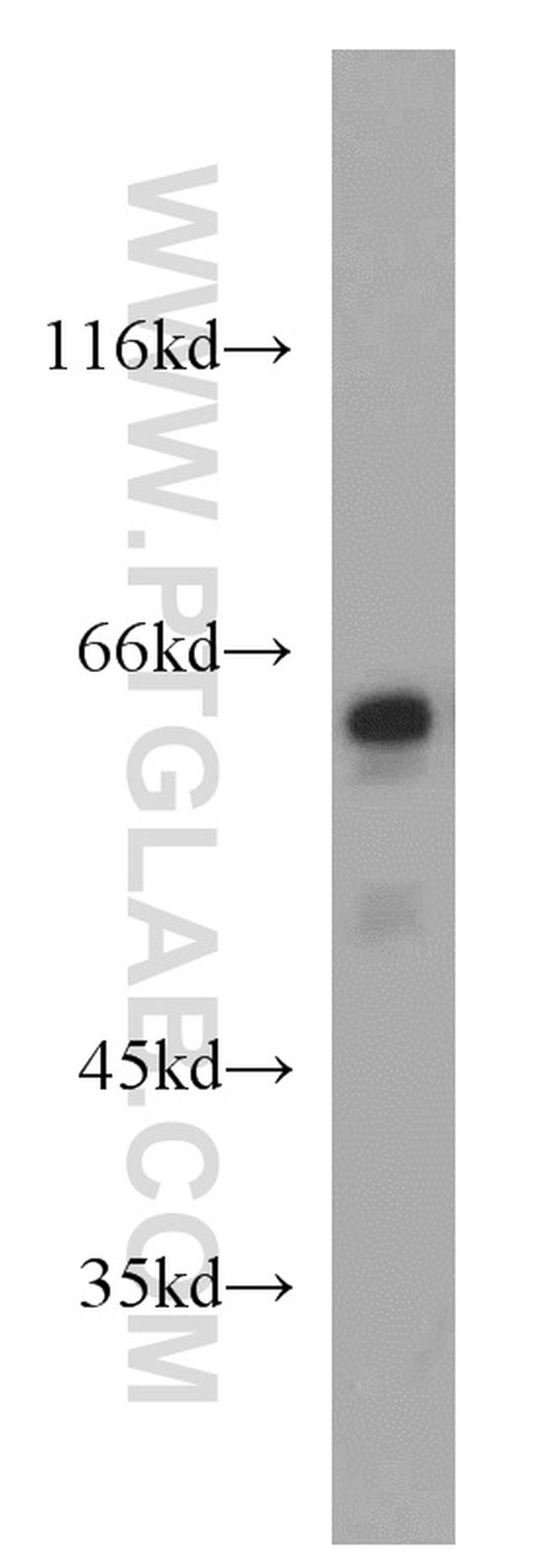 GLYR1 Antibody in Western Blot (WB)