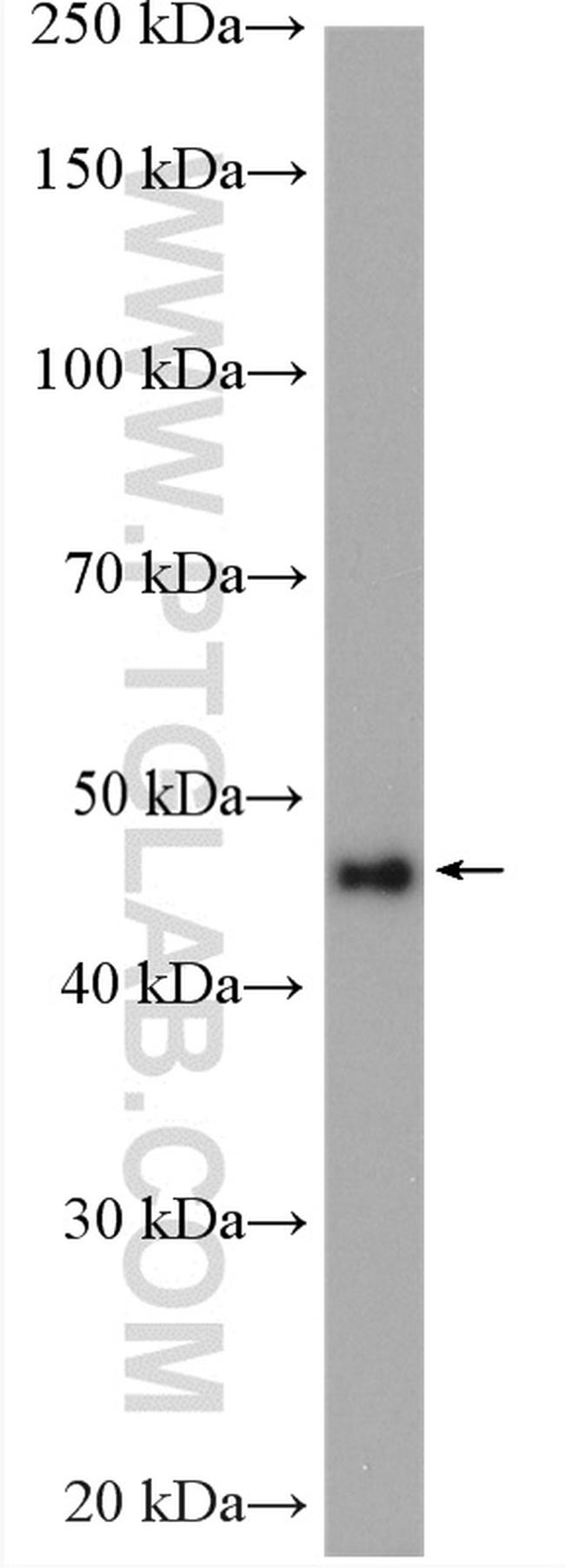 Phospho-Gsk3b (Ser389) Antibody in Western Blot (WB)