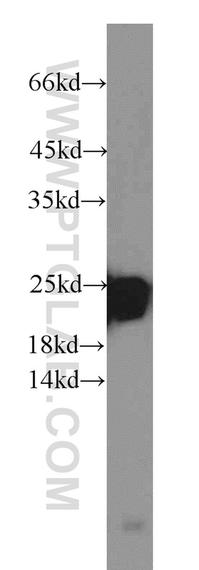 LMP7 Antibody in Western Blot (WB)