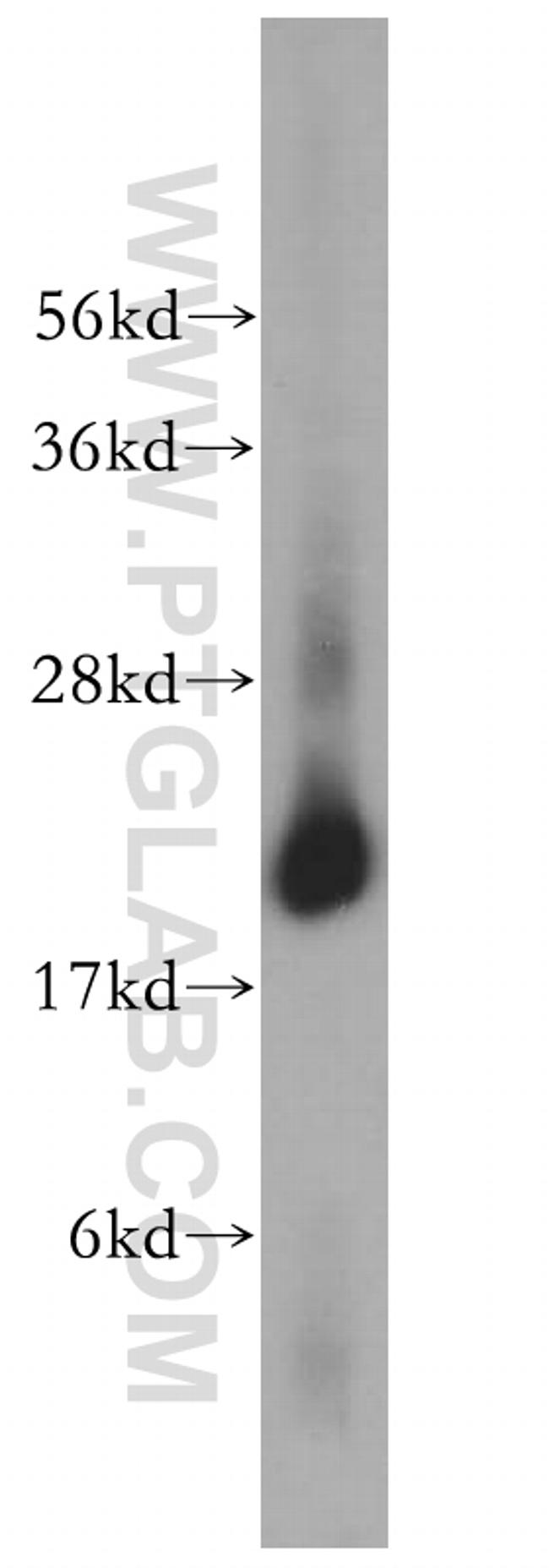 LMP7 Antibody in Western Blot (WB)