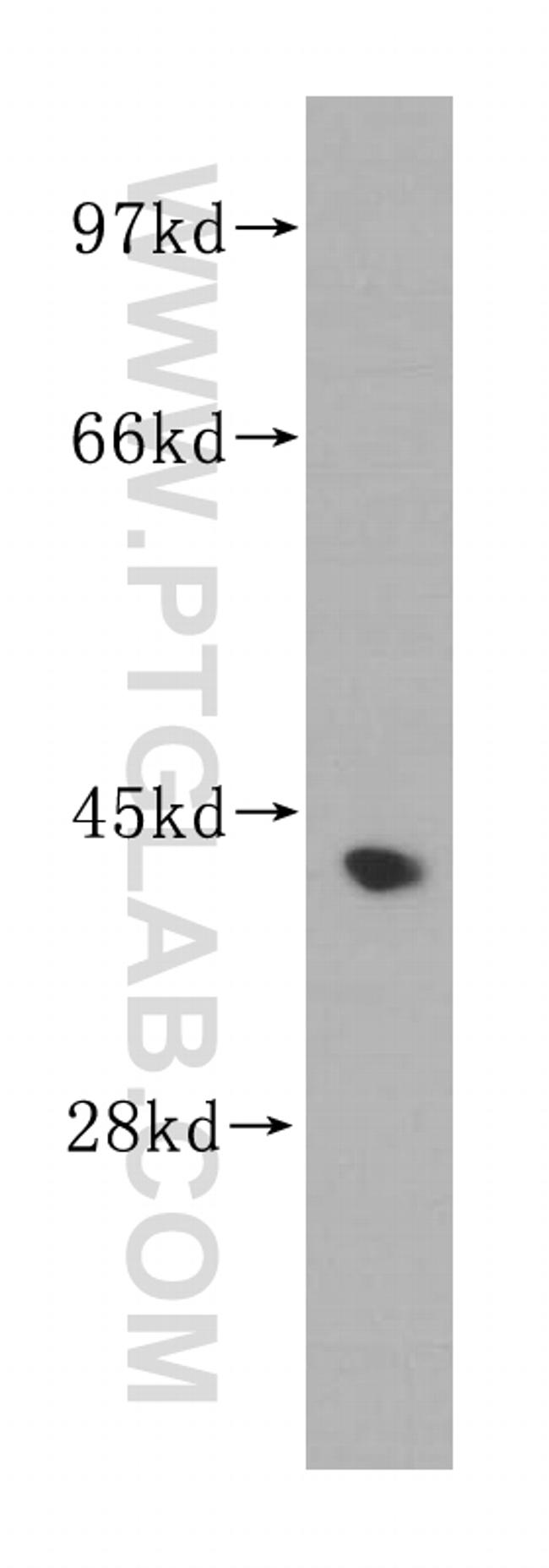 DHODH Antibody in Western Blot (WB)