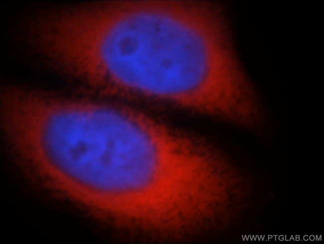 NAP1L1 Antibody in Immunocytochemistry (ICC/IF)