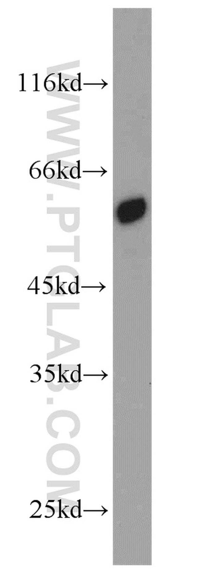 PSMD4 Antibody in Western Blot (WB)
