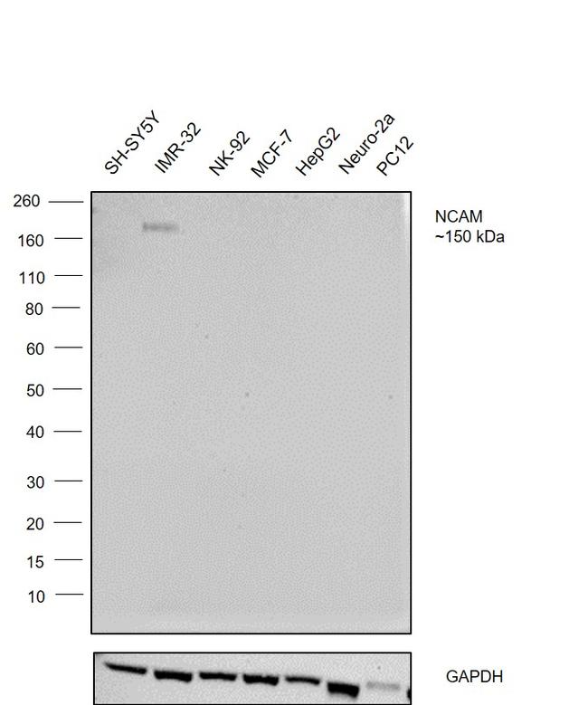 PSA-NCAM Antibody in Western Blot (WB)