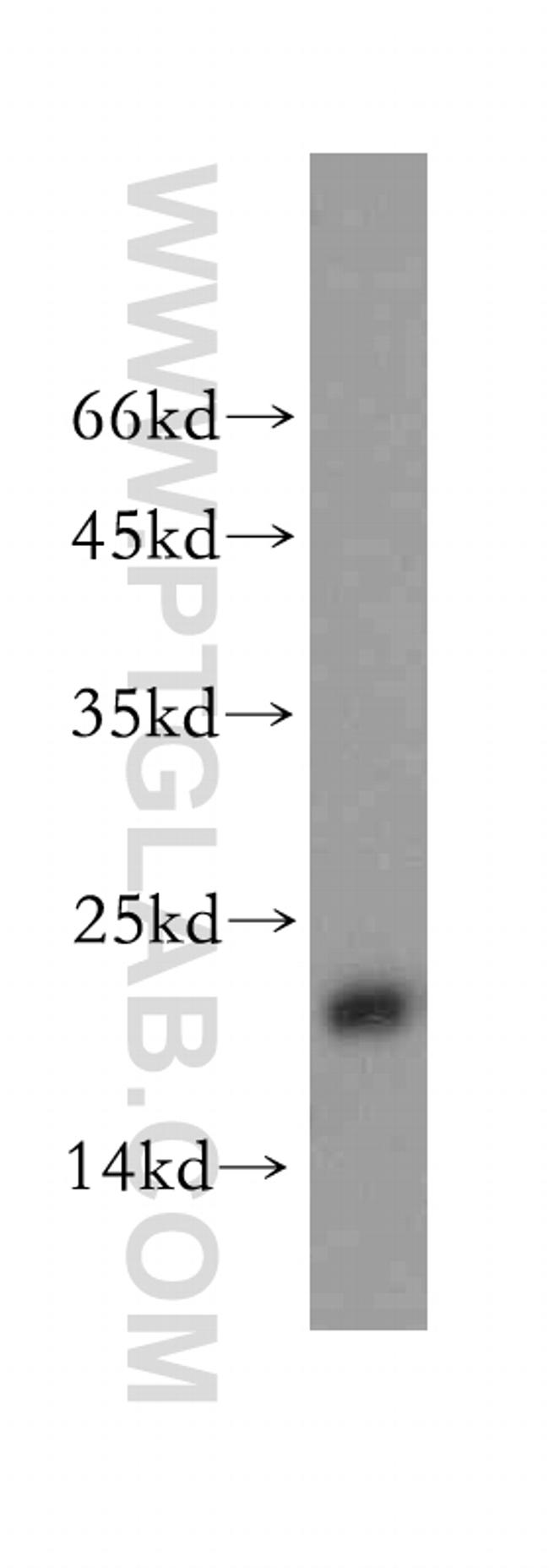 NDUFB7 Antibody in Western Blot (WB)