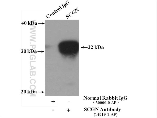 SCGN Antibody in Immunoprecipitation (IP)