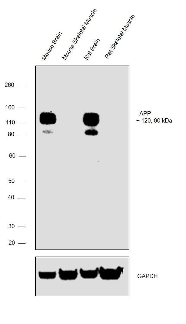 APP (Amyloid Precursor Protein) Antibody