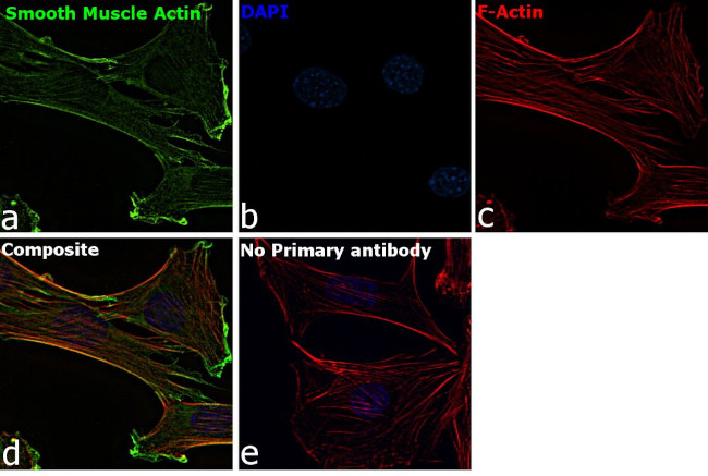 Alpha-Smooth Muscle Actin Antibody in Immunocytochemistry (ICC/IF)