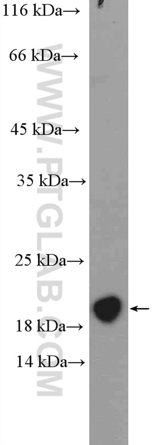 MCTS1 Antibody in Western Blot (WB)
