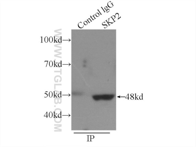 SKP2 Antibody in Immunoprecipitation (IP)