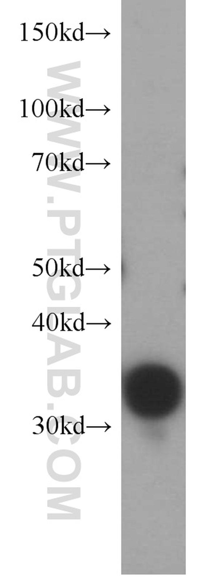 Thymidylate synthase Antibody in Western Blot (WB)