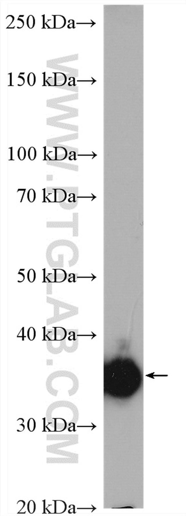 Thymidylate synthase Antibody in Western Blot (WB)