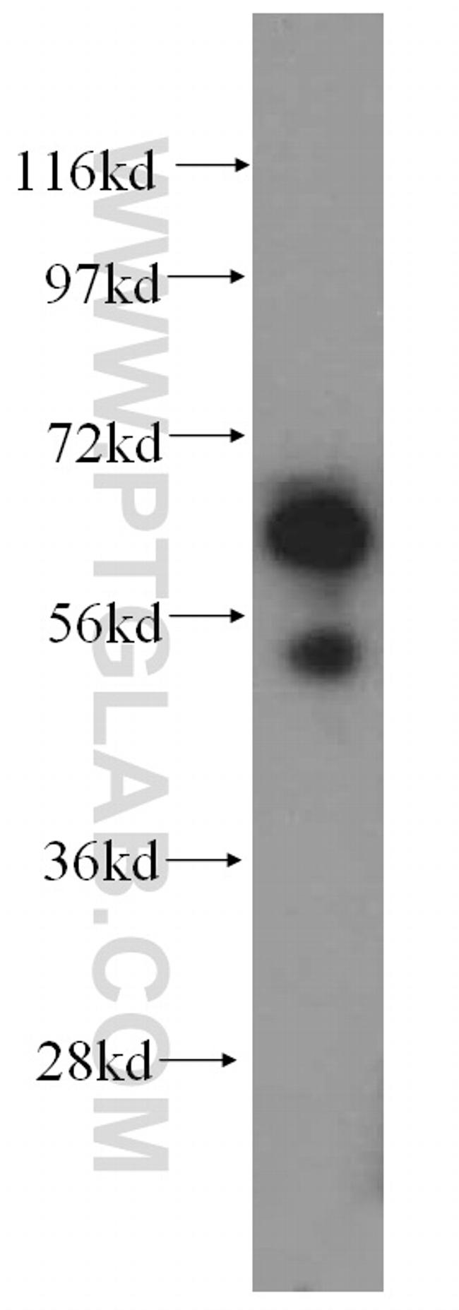 SUOX Antibody in Western Blot (WB)