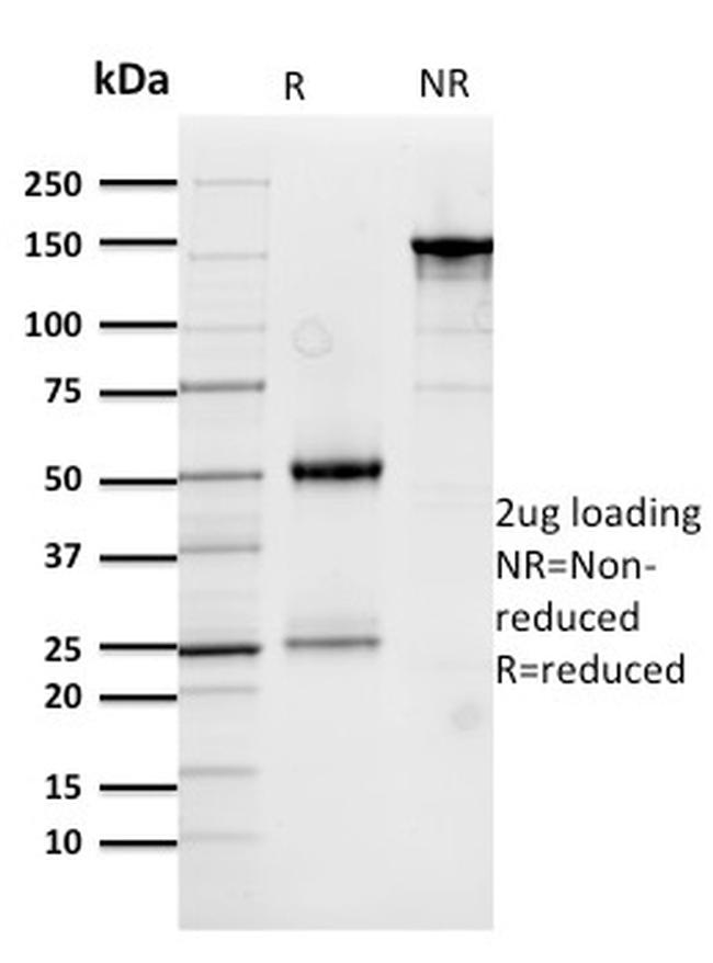 Cathepsin D Antibody in SDS-PAGE (SDS-PAGE)