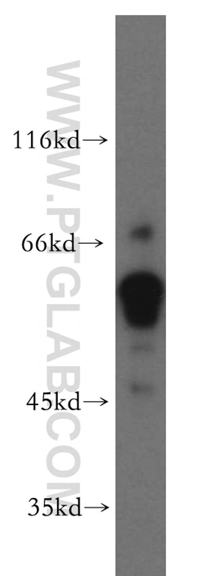 PCSK4 Antibody in Western Blot (WB)