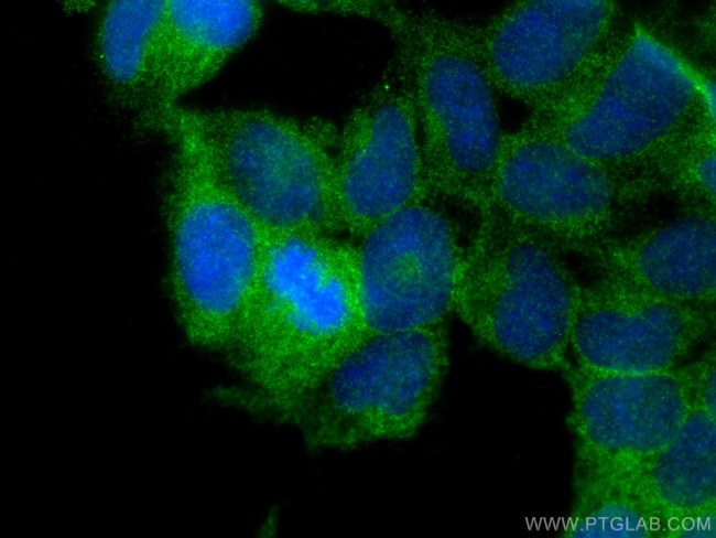 PHKG2 Antibody in Immunocytochemistry (ICC/IF)