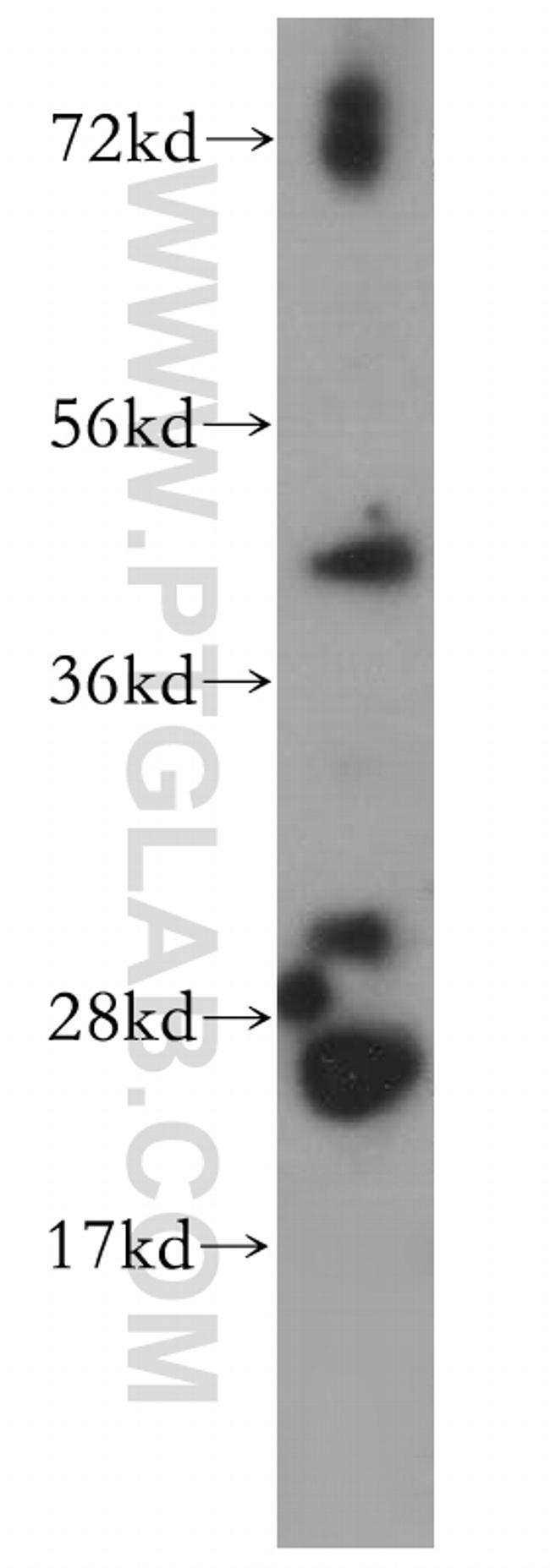 PHKG2 Antibody in Western Blot (WB)