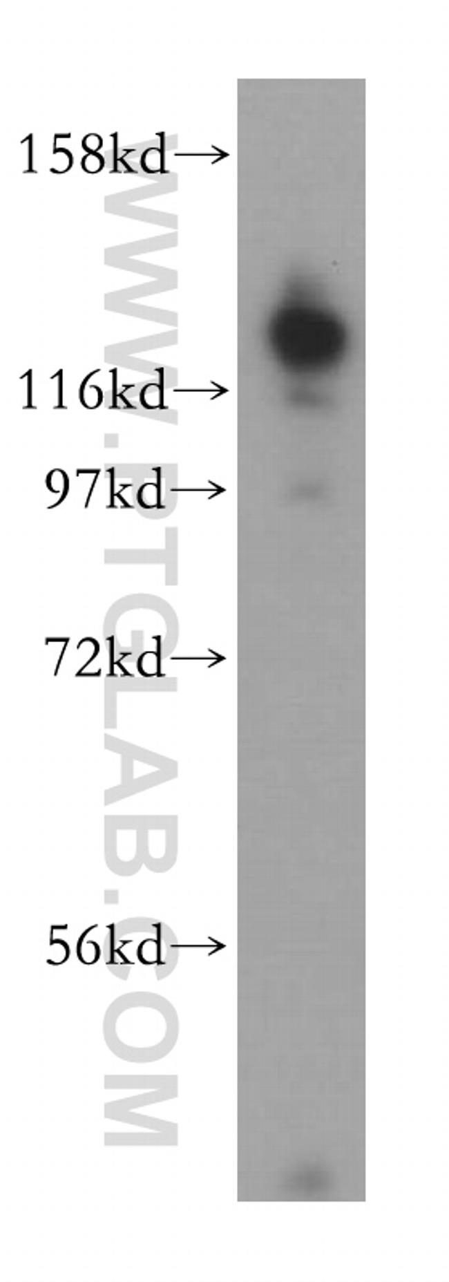 HRP 2 Antibody in Western Blot (WB)