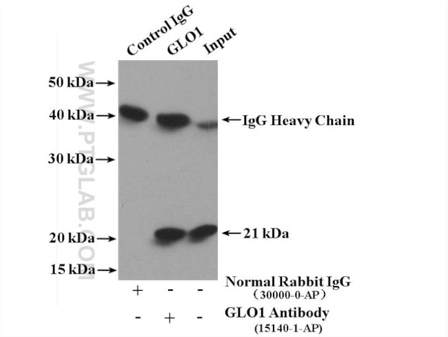 GLO1 Antibody in Immunoprecipitation (IP)