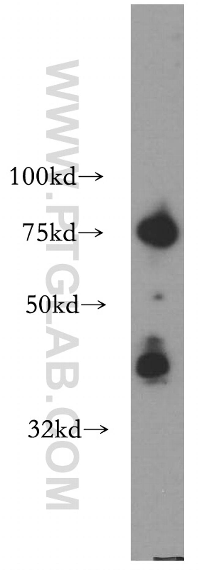 CA12 Antibody in Western Blot (WB)