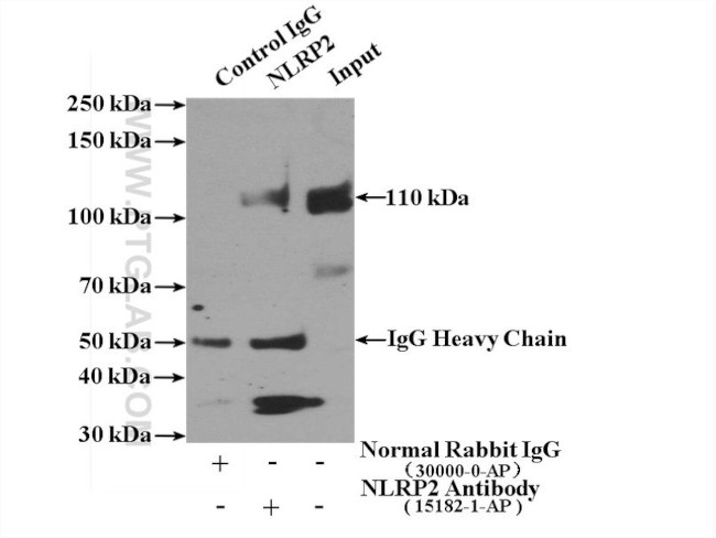 NLRP2 Antibody in Immunoprecipitation (IP)