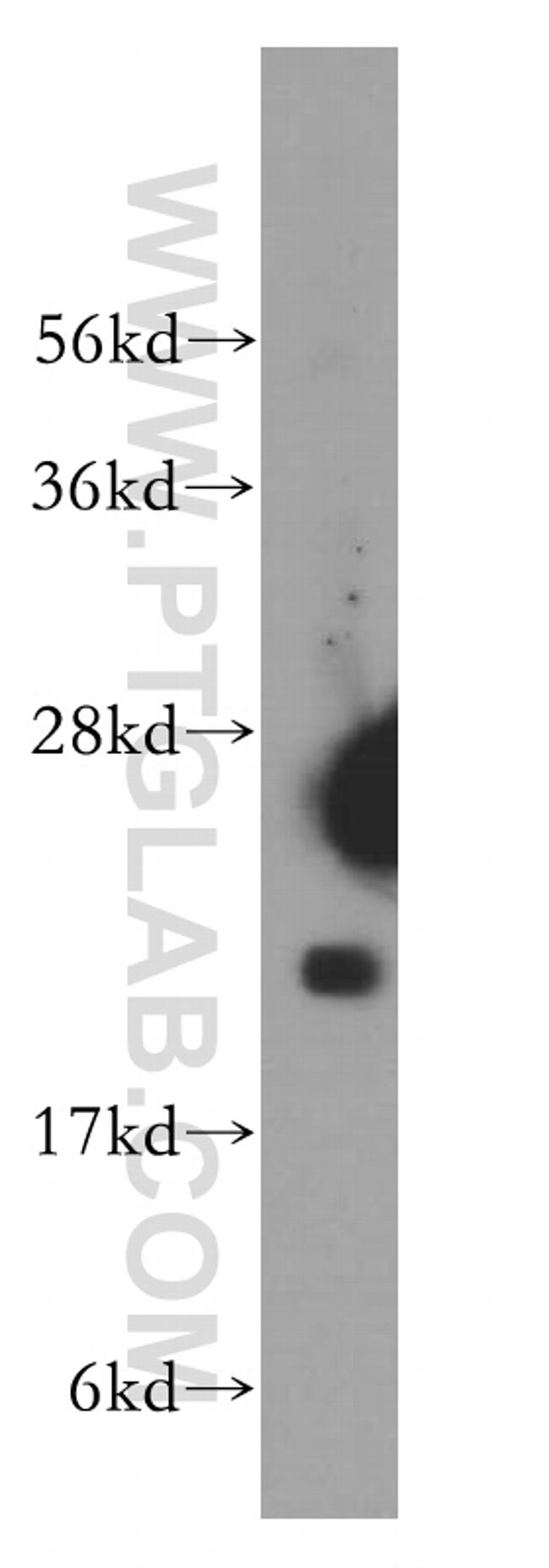 DHFR Antibody in Western Blot (WB)