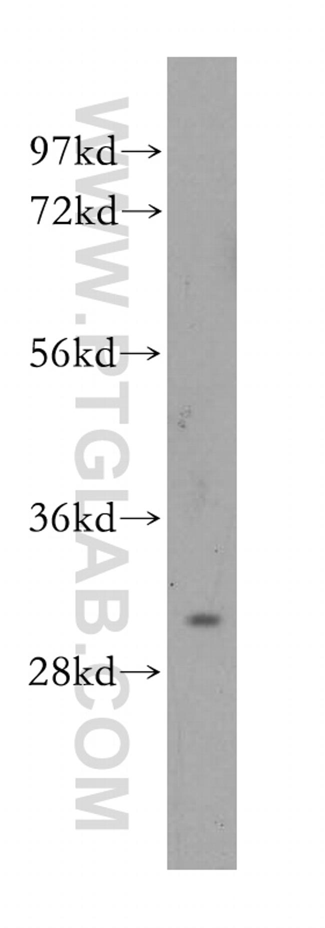 CA3 Antibody in Western Blot (WB)