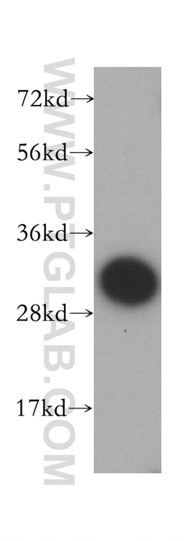 CA3 Antibody in Western Blot (WB)