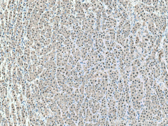 PSMA7 Antibody in Immunohistochemistry (Paraffin) (IHC (P))