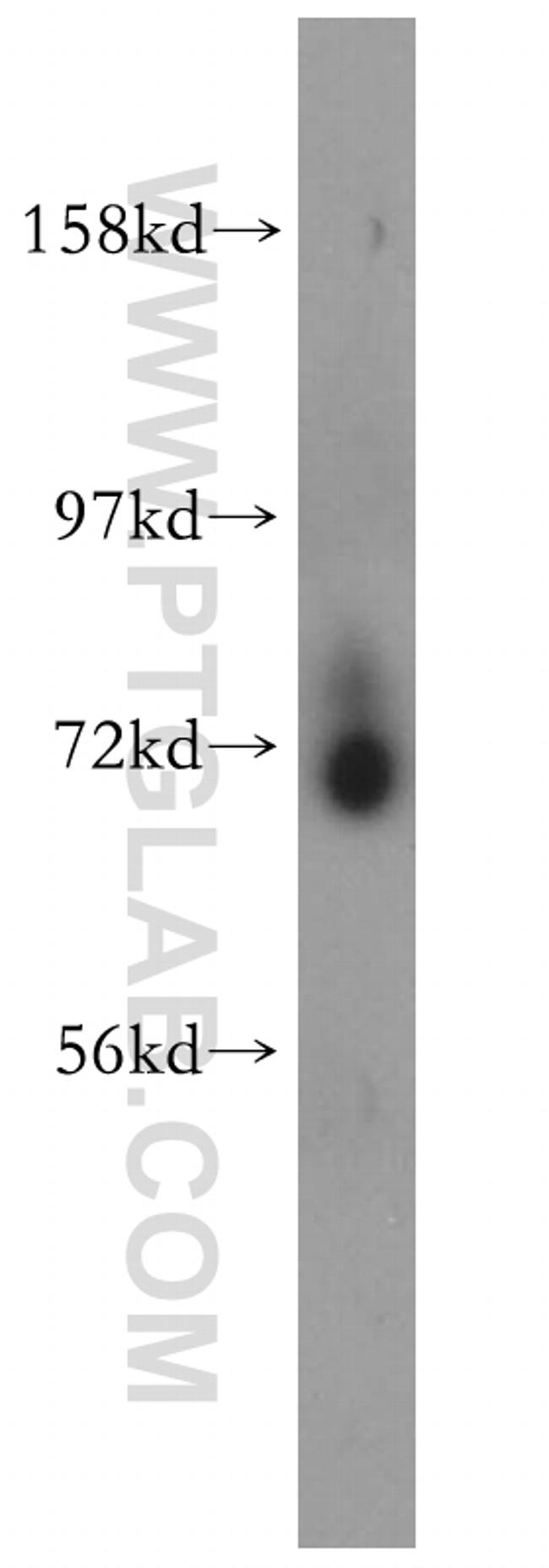 PCDHB5 Antibody in Western Blot (WB)