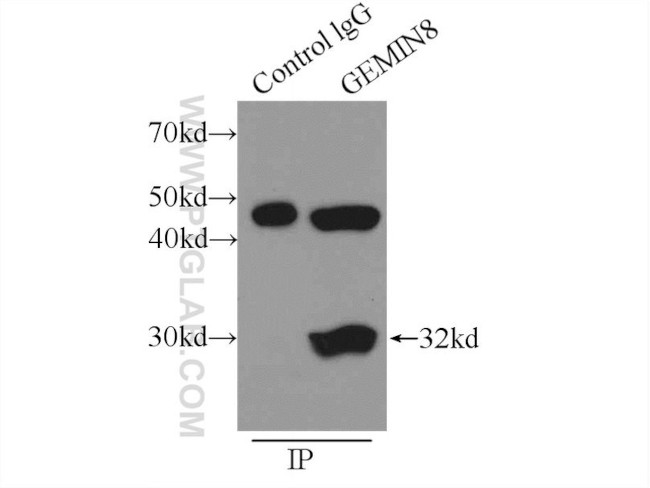 GEMIN8 Antibody in Immunoprecipitation (IP)