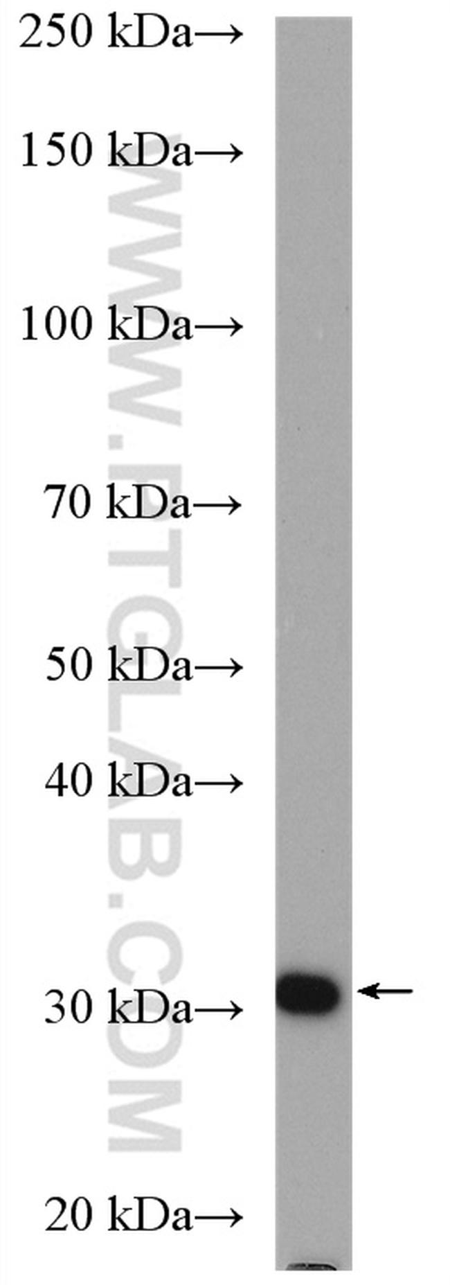ATP6V1E1 Antibody in Western Blot (WB)