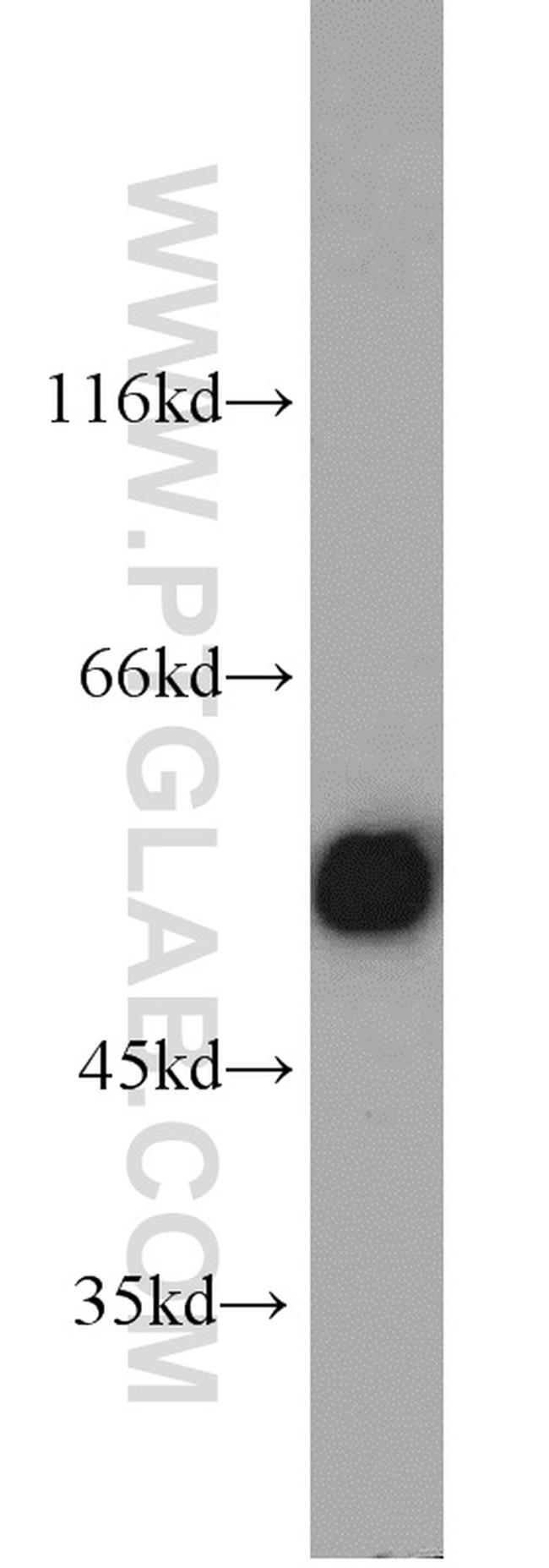 ALDH2 Antibody in Western Blot (WB)